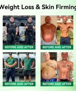 Luxarise® Moringa & Berberine 10-IN-1 Advanced Nano Microneedle Patch