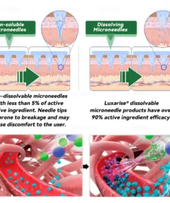 Luxarise® Moringa & Berberine 10-IN-1 Advanced Nano Microneedle Patch